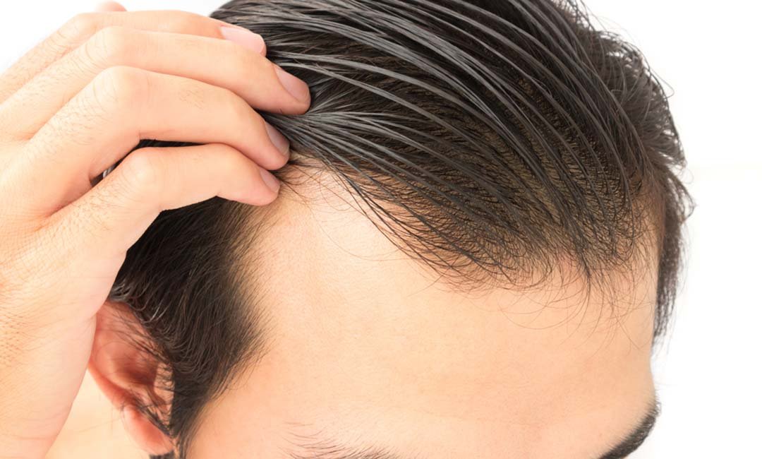 closeup man touching scalp